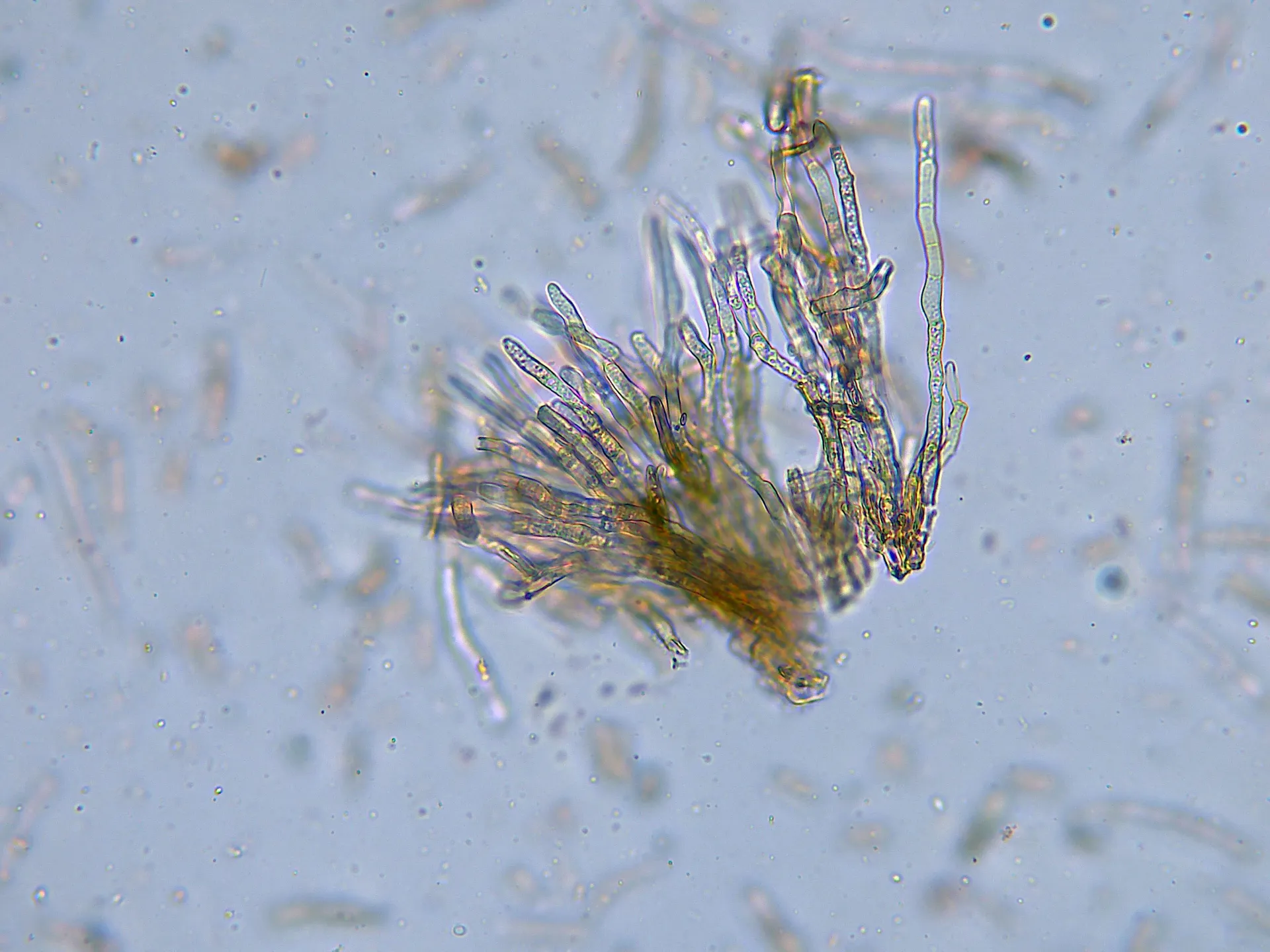 Microscopía de Scolecostigmina yuccae - 10 - Conidióforos x 400-002